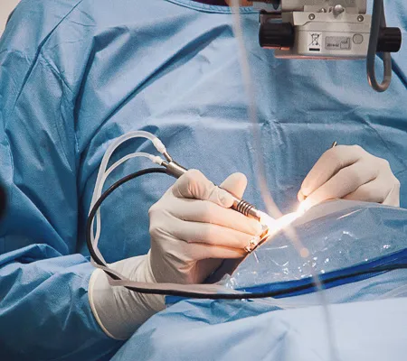 procedimiento de cirugia ocular de precision realizado por especialistas en ocumed queretaro