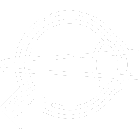 Esquema anatómico de ojo humano mostrando procedimiento quirúrgico para tratar cataratas en Ocumed Querétaro