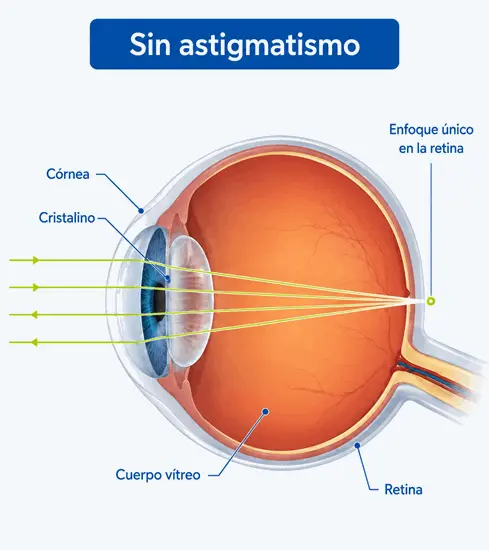 Diagrama anatomico del ojo humano mostrando el enfoque correcto de la luz sobre la retina en una persona sin astigmatismo