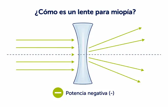 lente_para_miopia_concavo_potencia_negativa_ocumed_queretaro_660x422 Infografía de un lente cóncavo para Miopía que muestra la divergencia de los rayos de luz y su potencia negativa.