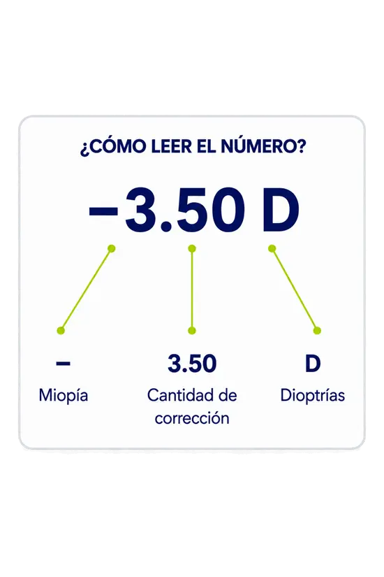 miopia_graduacion_dioptrias_ocumed_queretaro_550x825 Infografía educativa que explica cómo leer una graduación de Miopía mediante el ejemplo -3.50 D, identificando el signo negativo, la magnitud 3.50 y las dioptrías.